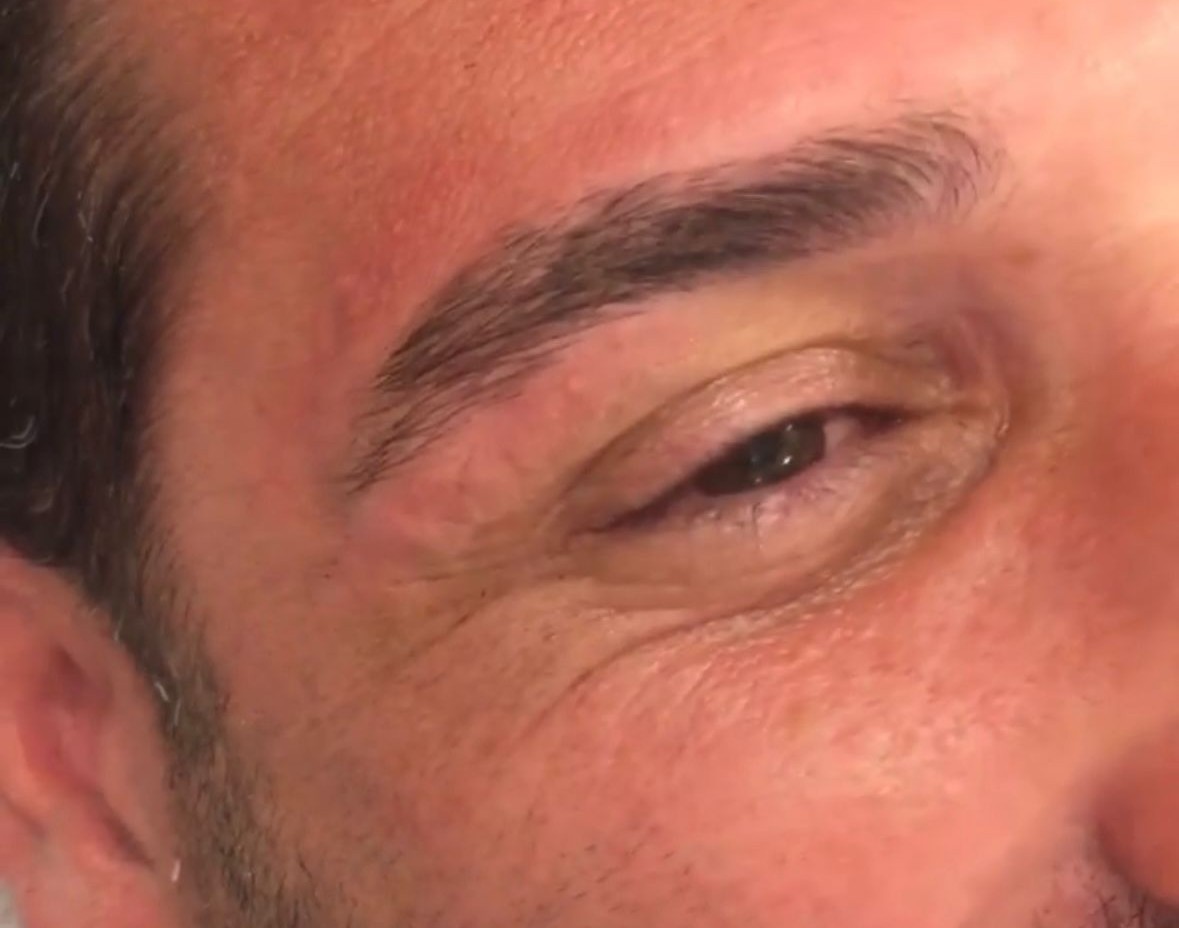 Résultat sourcil homme